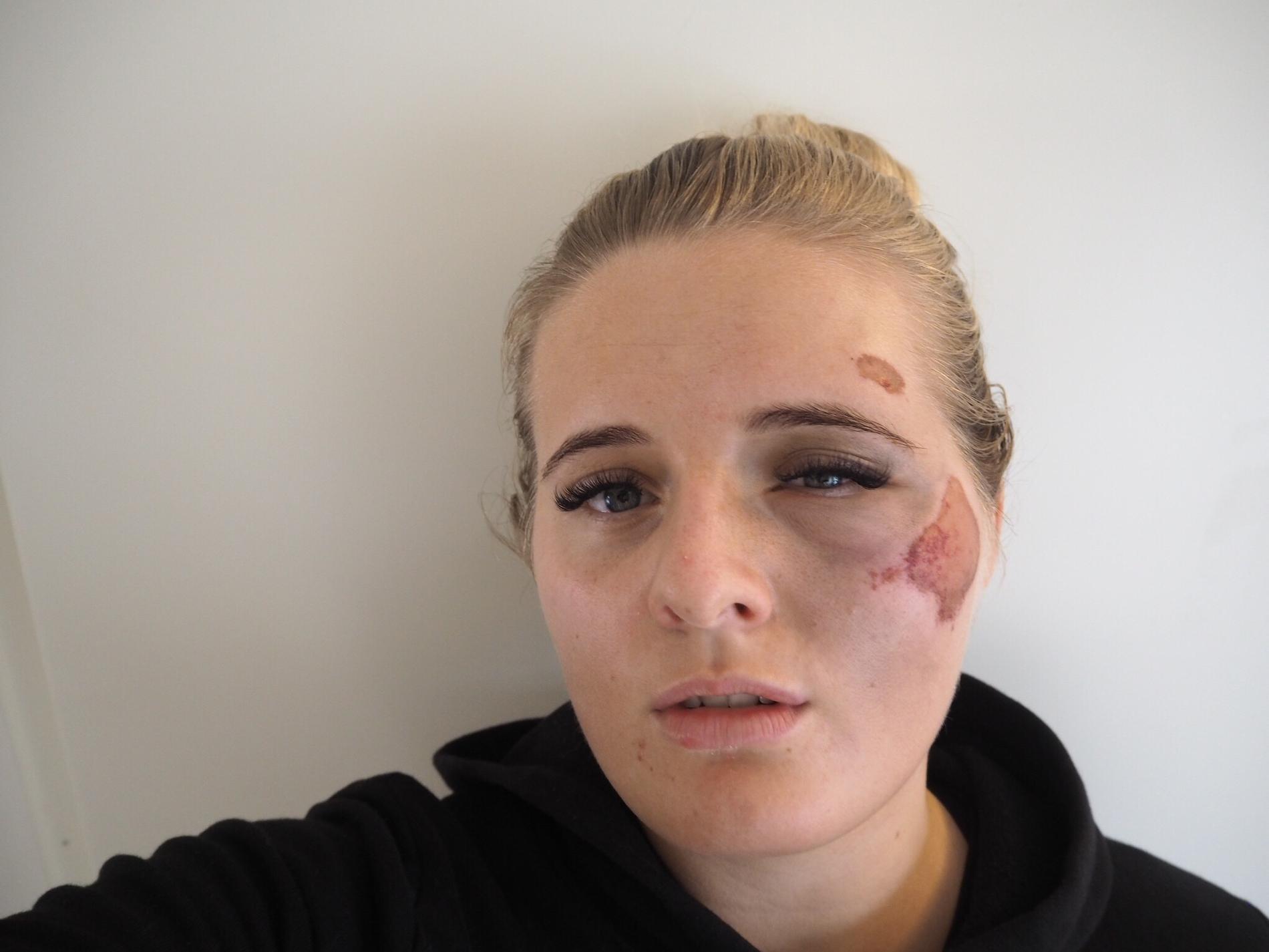 Martine Halvorsen blev misshandlad när hon skulle gå ut med soporna.