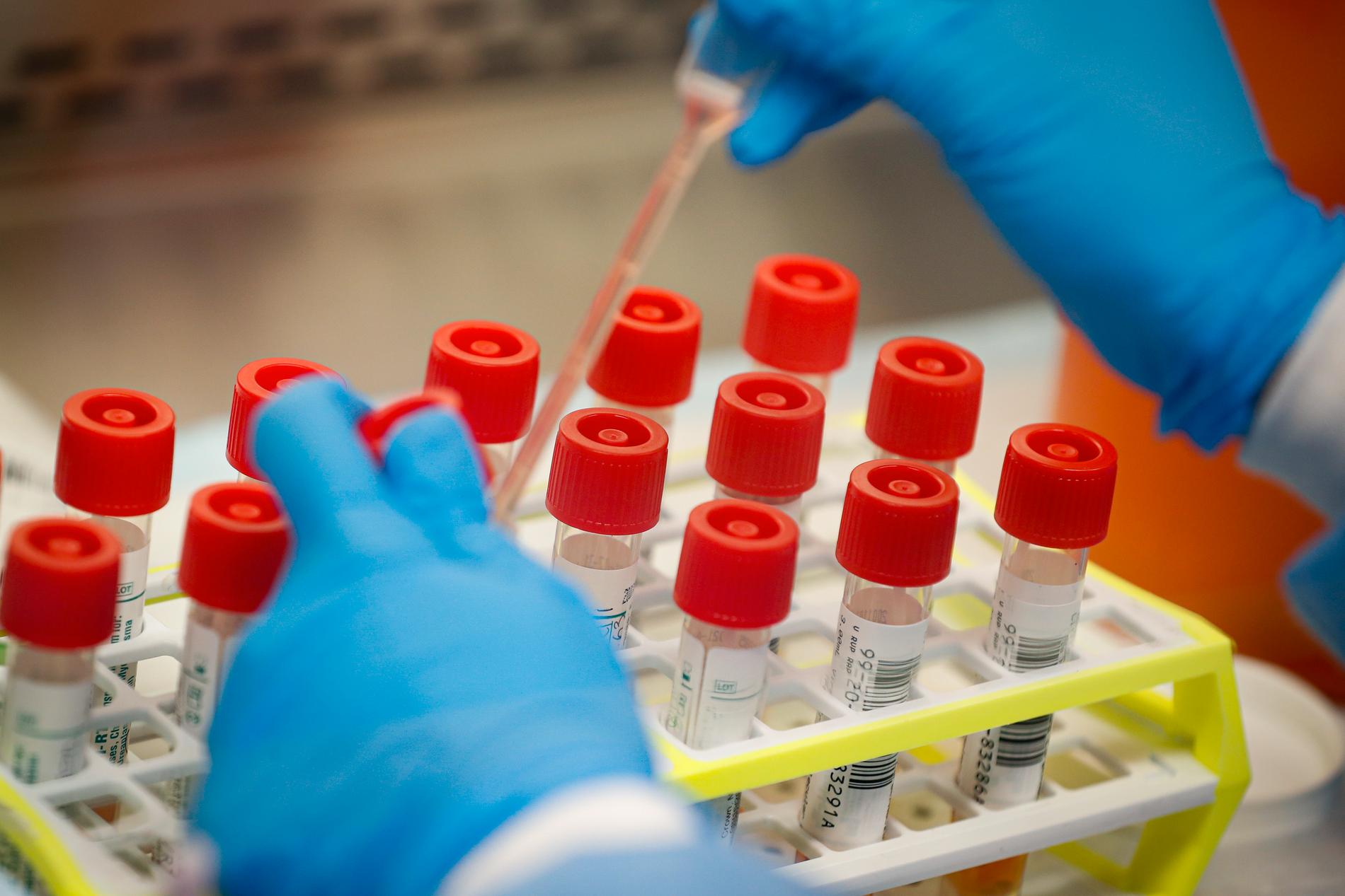Laboratorietekniker förbereder patientprover för covid-19-test.