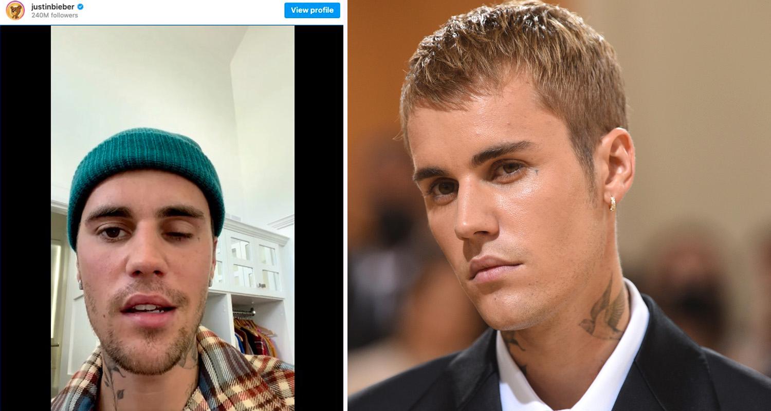 Justin Bieber visade upp ansiktsförlamningen på sin egen Instagram.