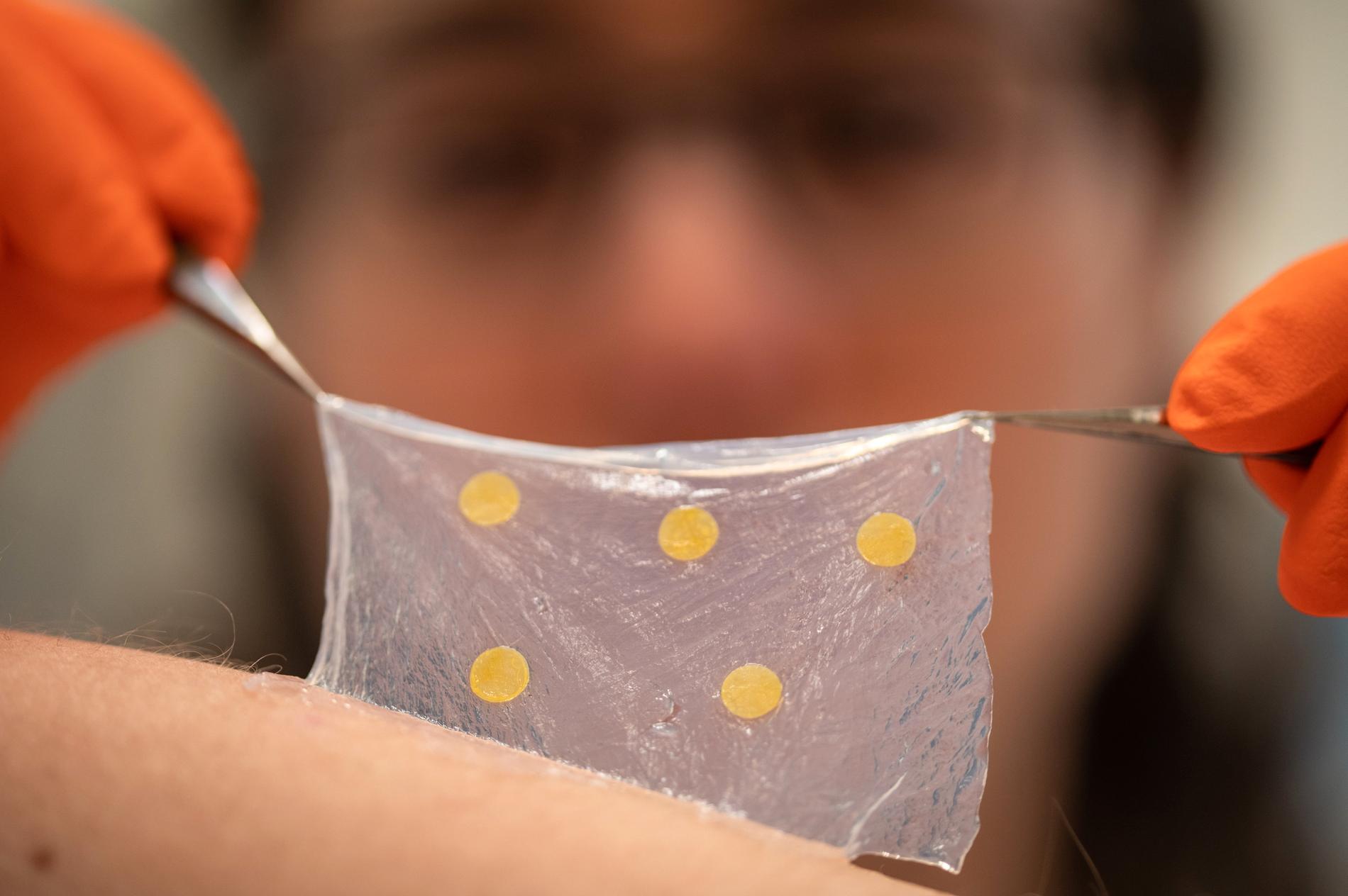 Ett sårförband av nanocellulosa som kan skvallra om infektioner har utvecklats av forskare vid bland annat Linköpings universitet.