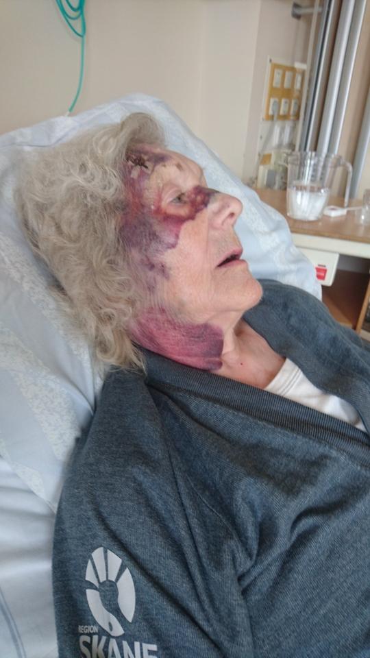 Estrid Holmér, 92, skadade sig när hon föll ur rullstolen på väg från affären.