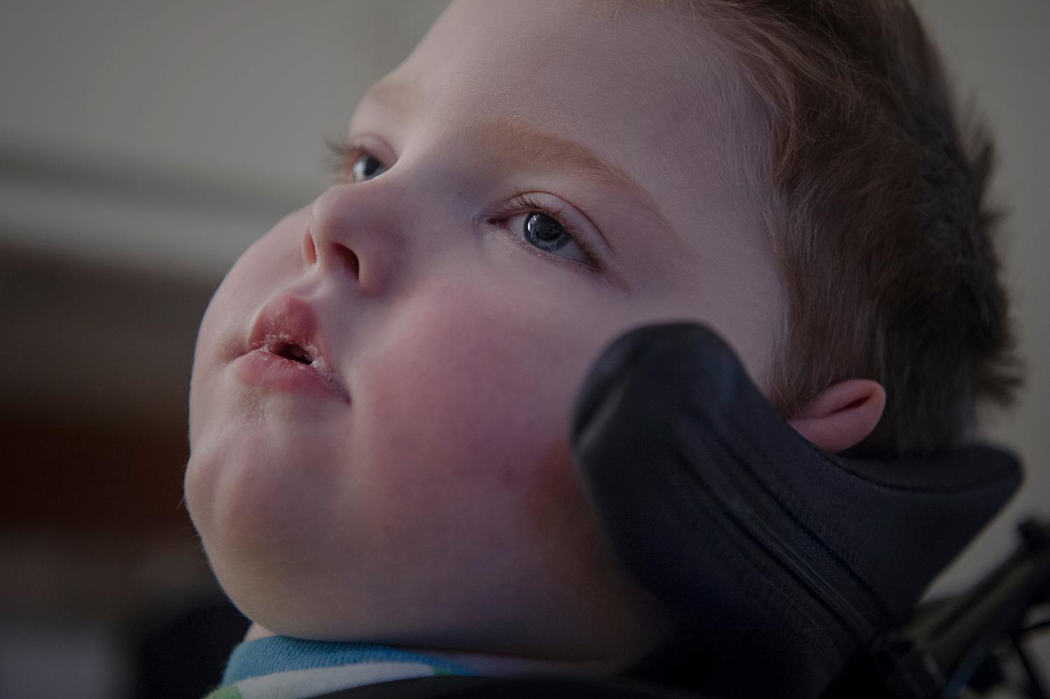 Olof, 2, har kraftigt nedsatt syn och ser inte. Han kan heller inte tolka hörselintryck, inte le, inte skratta, inte hosta, inte äta. Hans enda förmåga är att skrika när han har ont.