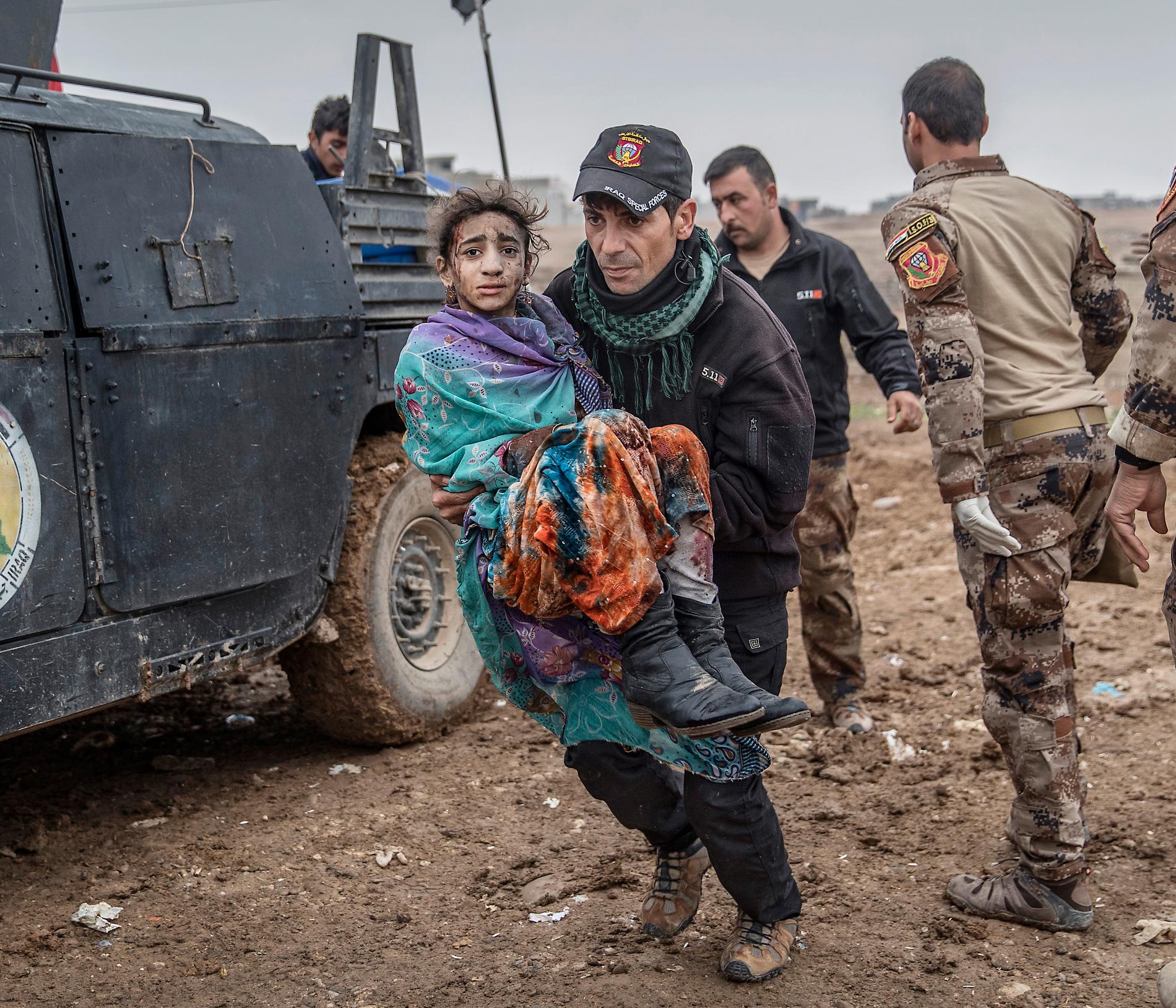 Årets fotograf 2017, Magnus Wennman. Tolvåriga Wijdan Moofik anländer till en fältklinik vid frontlinjen i Mosul. Hon är svårt skadad. Sjukvårdarna gör sitt bästa för att stoppa blödningen. För bara tio minuter sedan lekte hon med sina syskon i ett garage i stadsdelen Khadisey. Familjen hade överlevt två år och fem månader och tjugoen dagar med IS. Men när befrielsen kommit, när räddningen bokstavligen stod utanför deras dörr, krossades allt av slumpen och en inkommande IS-granat.