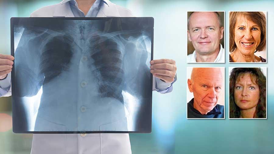 Lungcancerföreningen kräver att screening omgående införs för riskgrupper i hela landet. I Sverige skulle det rädda 400–500 liv per år, skriver debattörerna.
