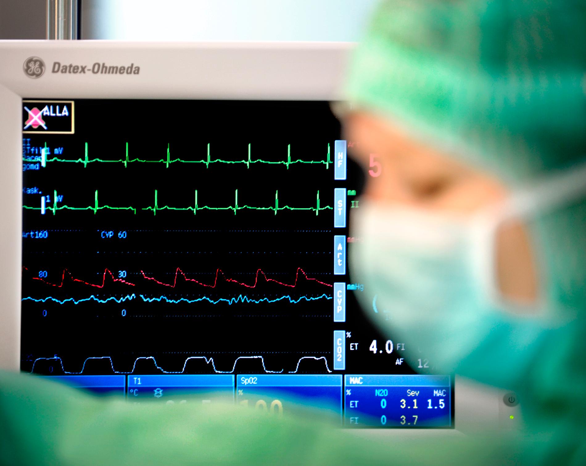 Bilden är från en hjärtoperation på S:t Görans sjukhus i Stockholm och har ingen koppling till studien. Arkivbild.