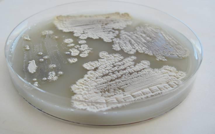 Streptomyces-bakterier i en petriskål.