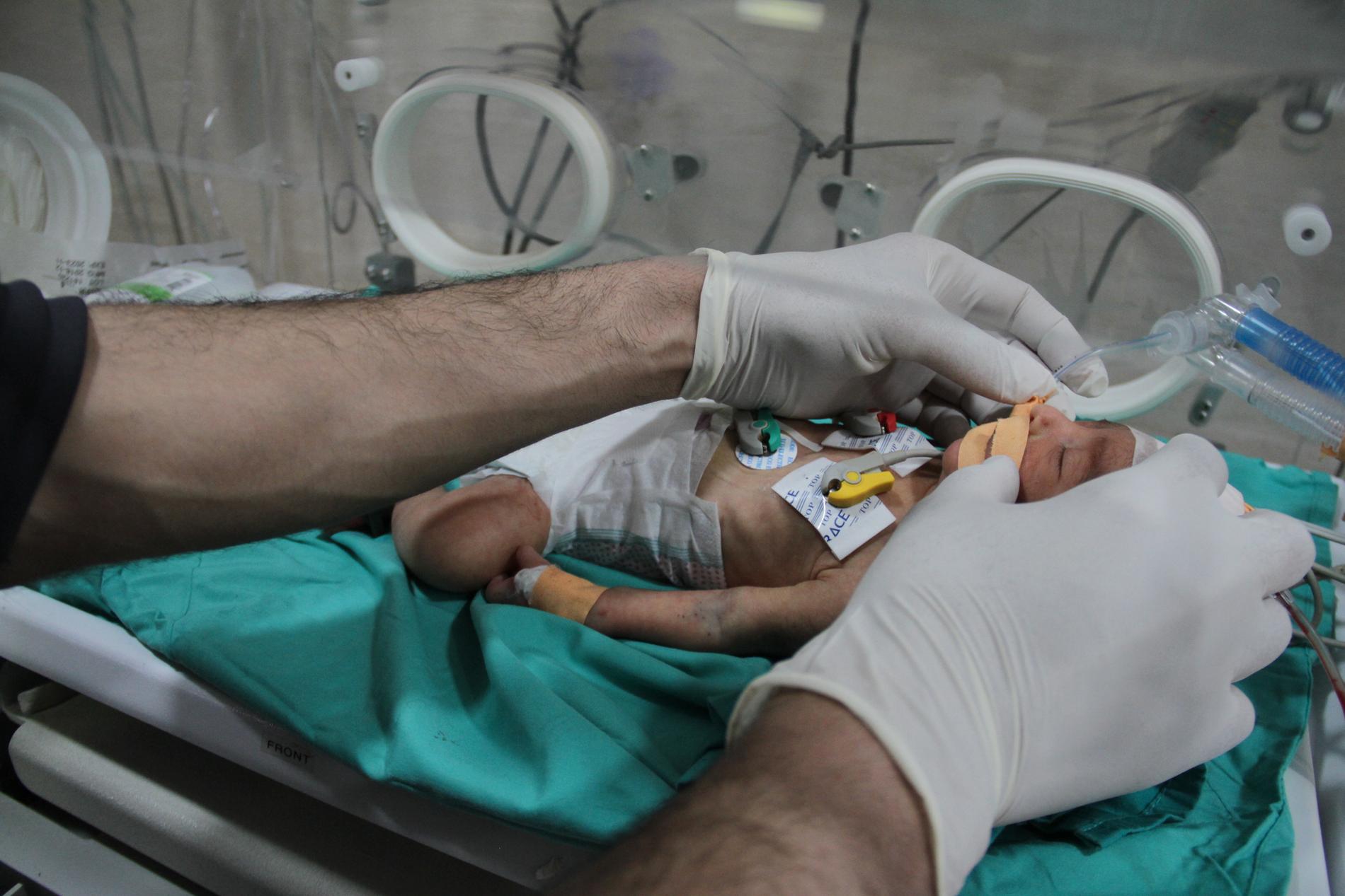 En bebis vårdas för undernäring och uttorkning i en kuvös på Kamal Adwan-sjukhuset i Beit Lahia i norra Gaza. Bilden är tagen 2 mars. 