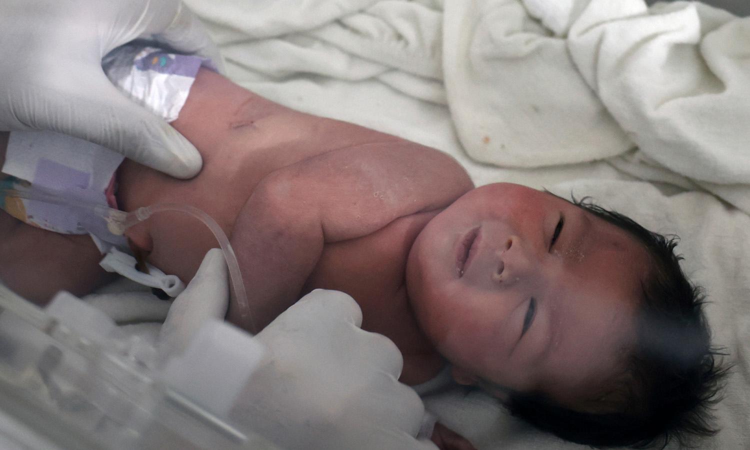 Nyförlöst bebis räddades ur rasmassorna