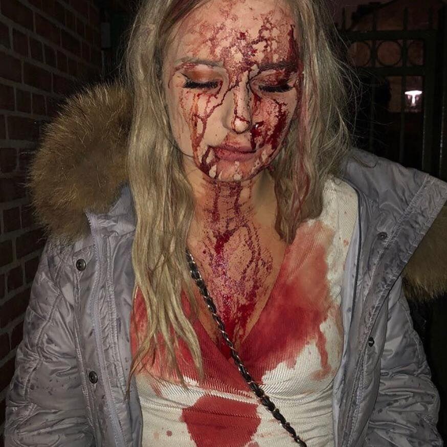 19-åriga Sophie slogs blodiga efter att hon försökt stoppa en man från att tafsa på henne. 
