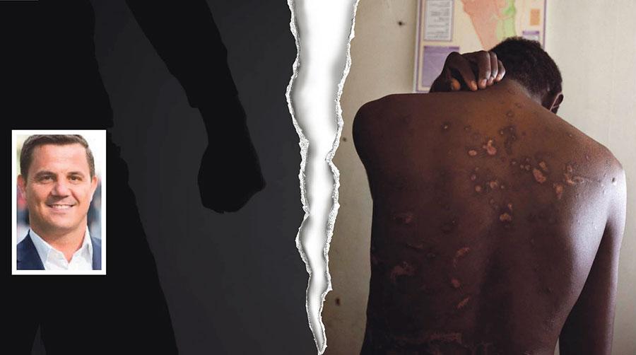 Bristen på medicinska undersökning innebär att tortyröverlevare riskerar att få fel diagnoser och fel insatser och därmed tvingas leva med smärta under resten av livet – något som är torterarens avsikt, skriver Salah Haghgo. På bilden till höger en man utsatt för tortyr i ett läger i Egypten.