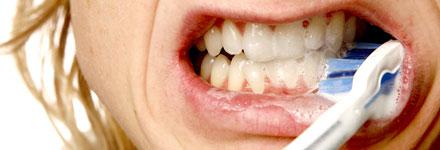 VAR NOGA med rengöringen av tänderna för att slippa riskera att drabbas av tandlossning.