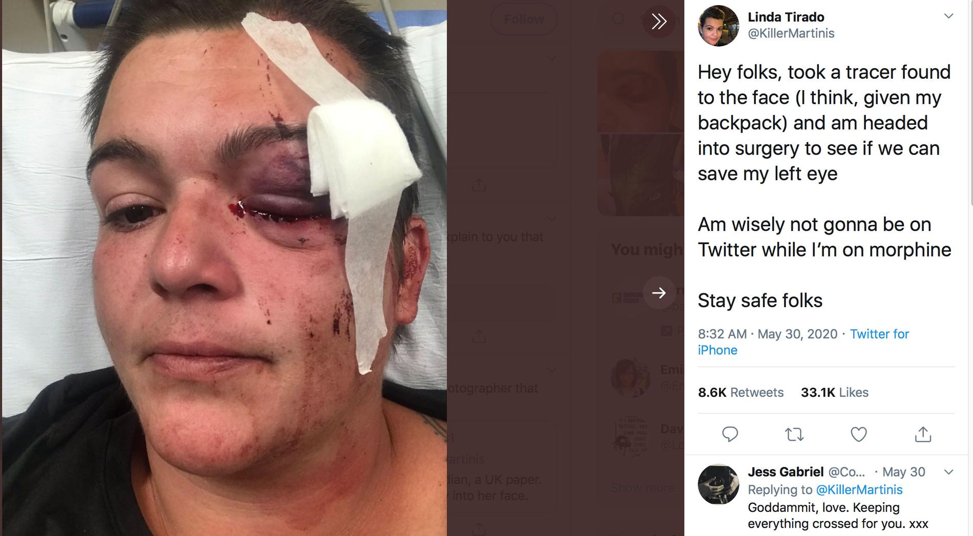 På Twitter berättar frilansfotografen Linda Tirado om läkarnas kamp för att rädda hennes öga.