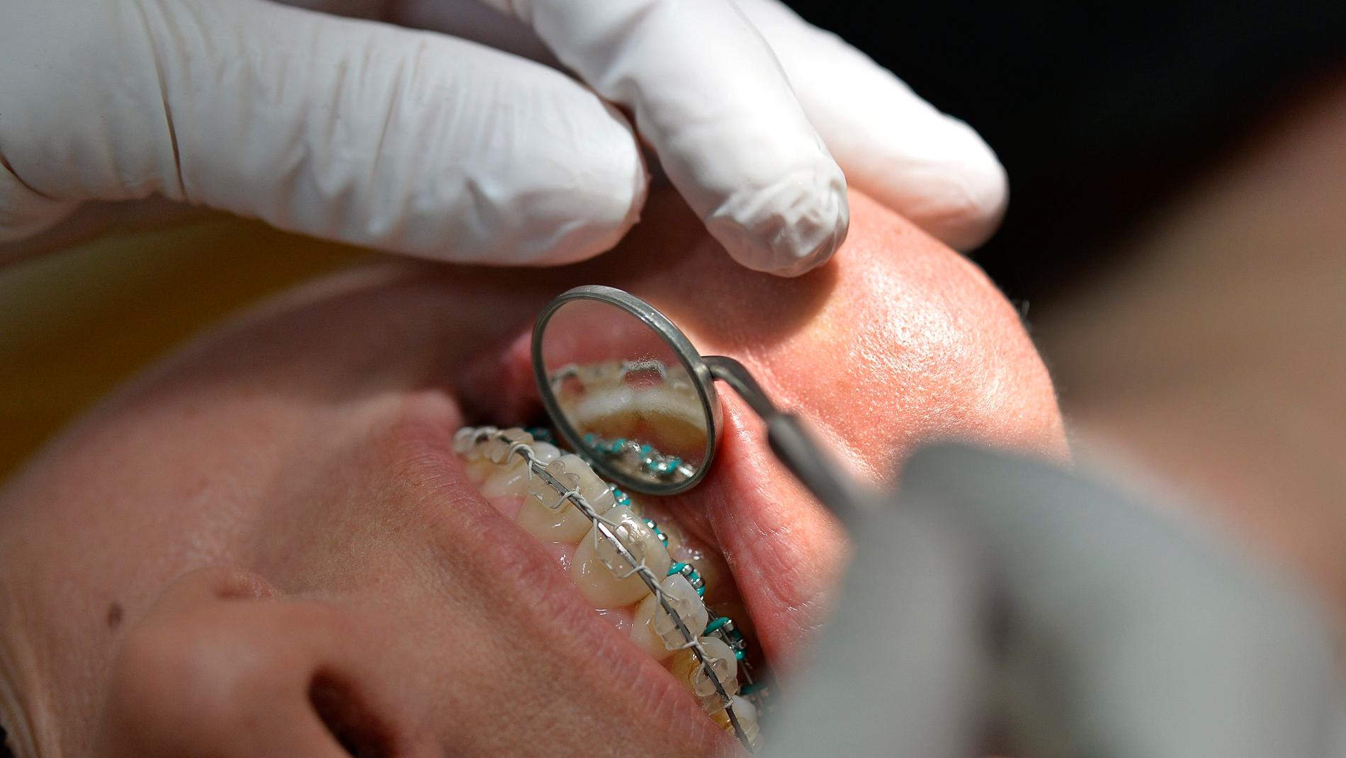 Åklagaren väljer att avgränsa utredningen mot den tandläkare i Västsverige som har anmälts för nästan 200 felbehandlingar och skador. Arkivbild.