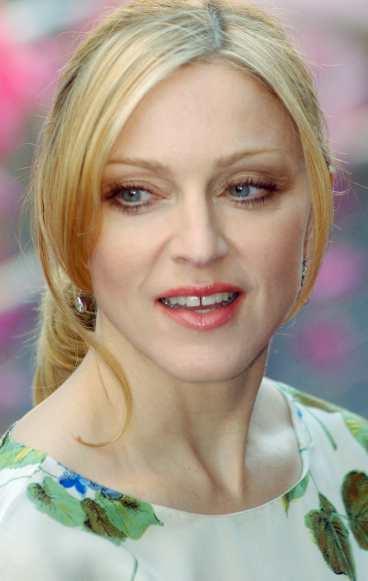 Madonna gillar botox.
