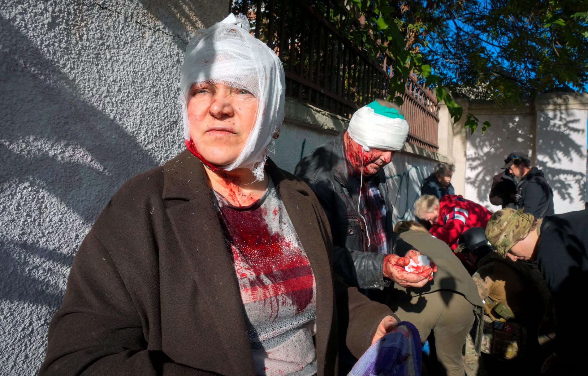 Skadade människor efter en attack mot Kiev i Ukraina den 10 oktober.
