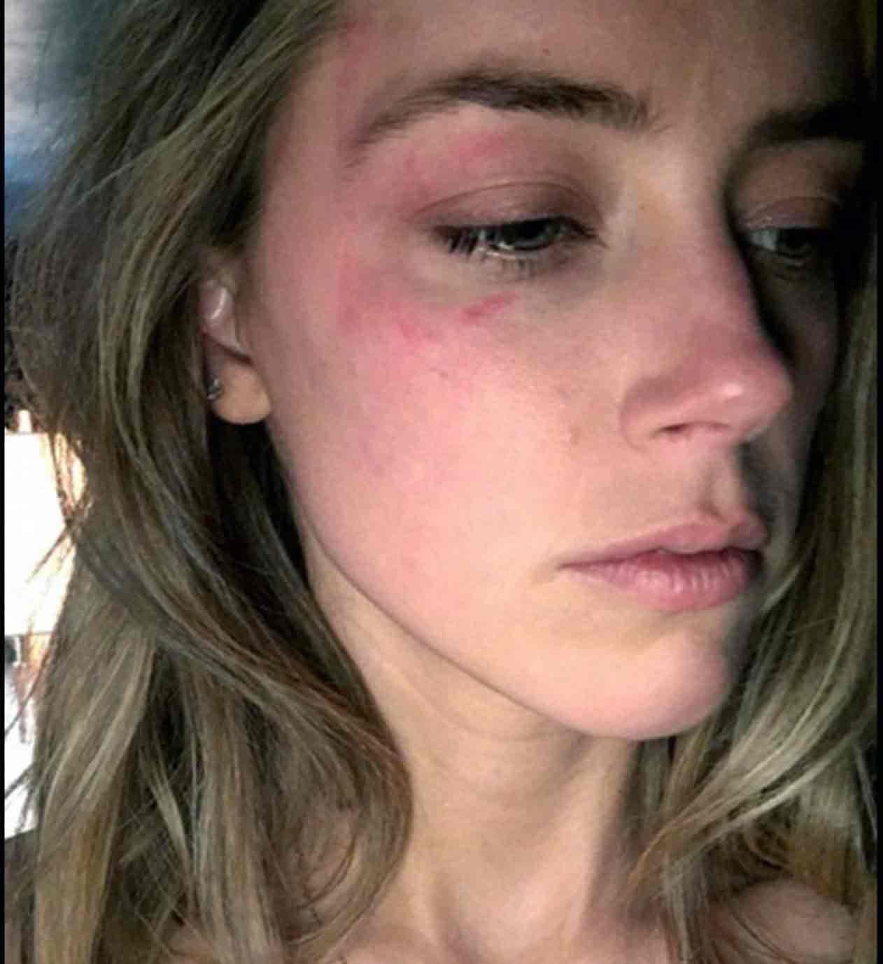 Amber Heard visade upp bilder på sig själv blåslagen i rätten under fredagen.