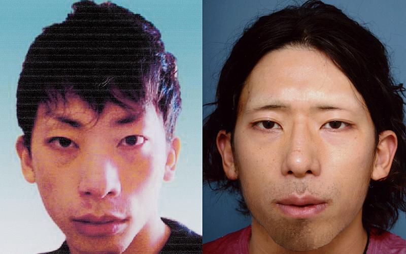 Tatsuya Ichihashi - före och efter plastikoperationen.