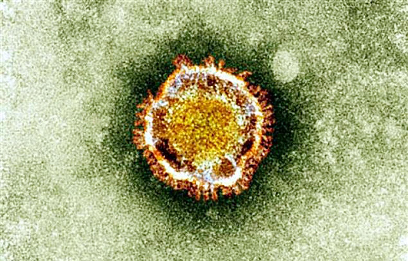 Viruset sett i mikroskop.