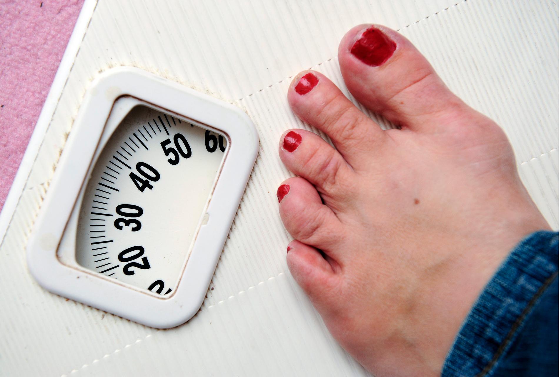 Ätstörningspatienter som väger mer får vänta längre på vård. Arkivbild.