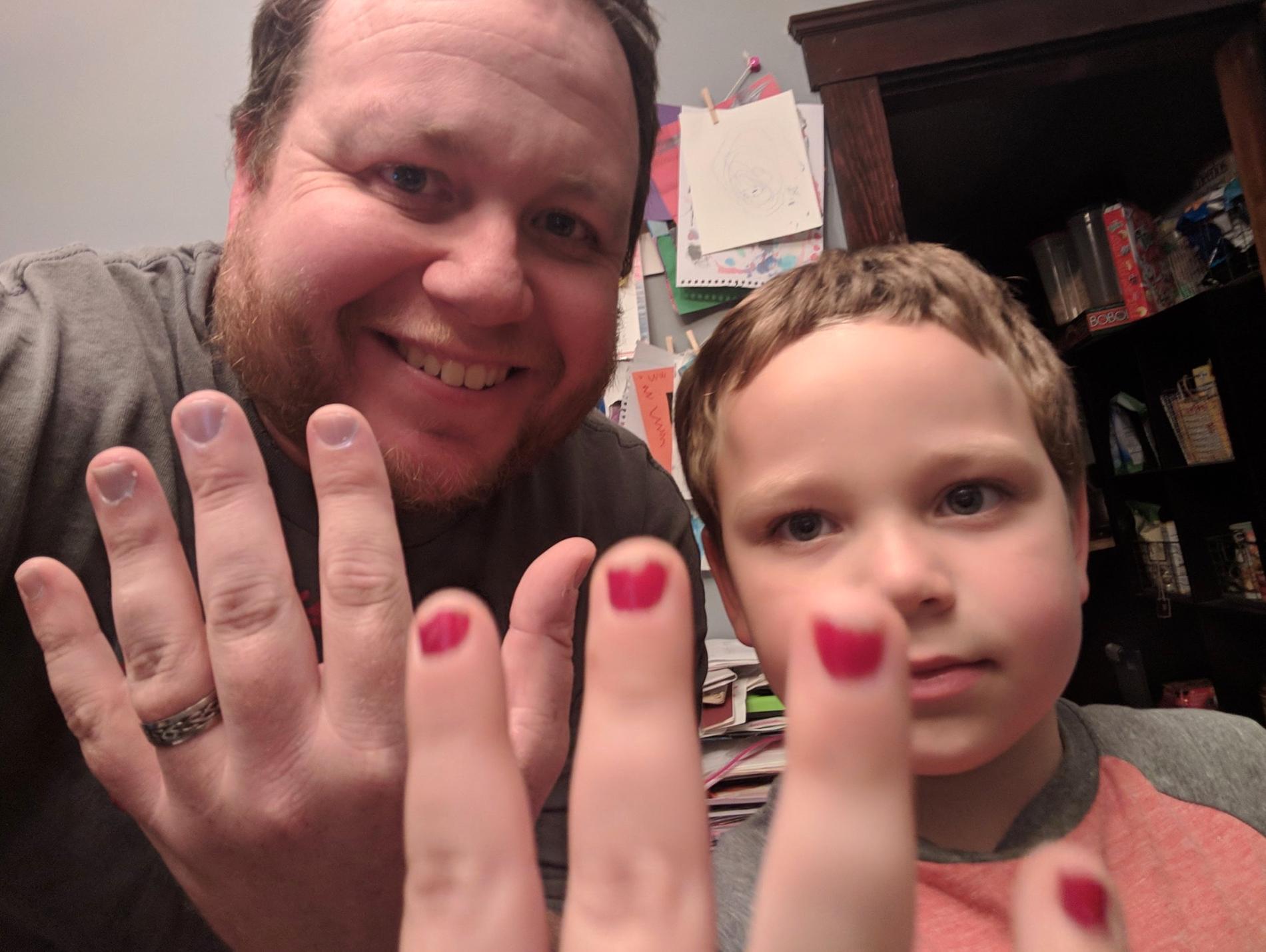Pappan Aaron bestämde sig för att måla sina egna naglar  för att visa stöd till sin son. 