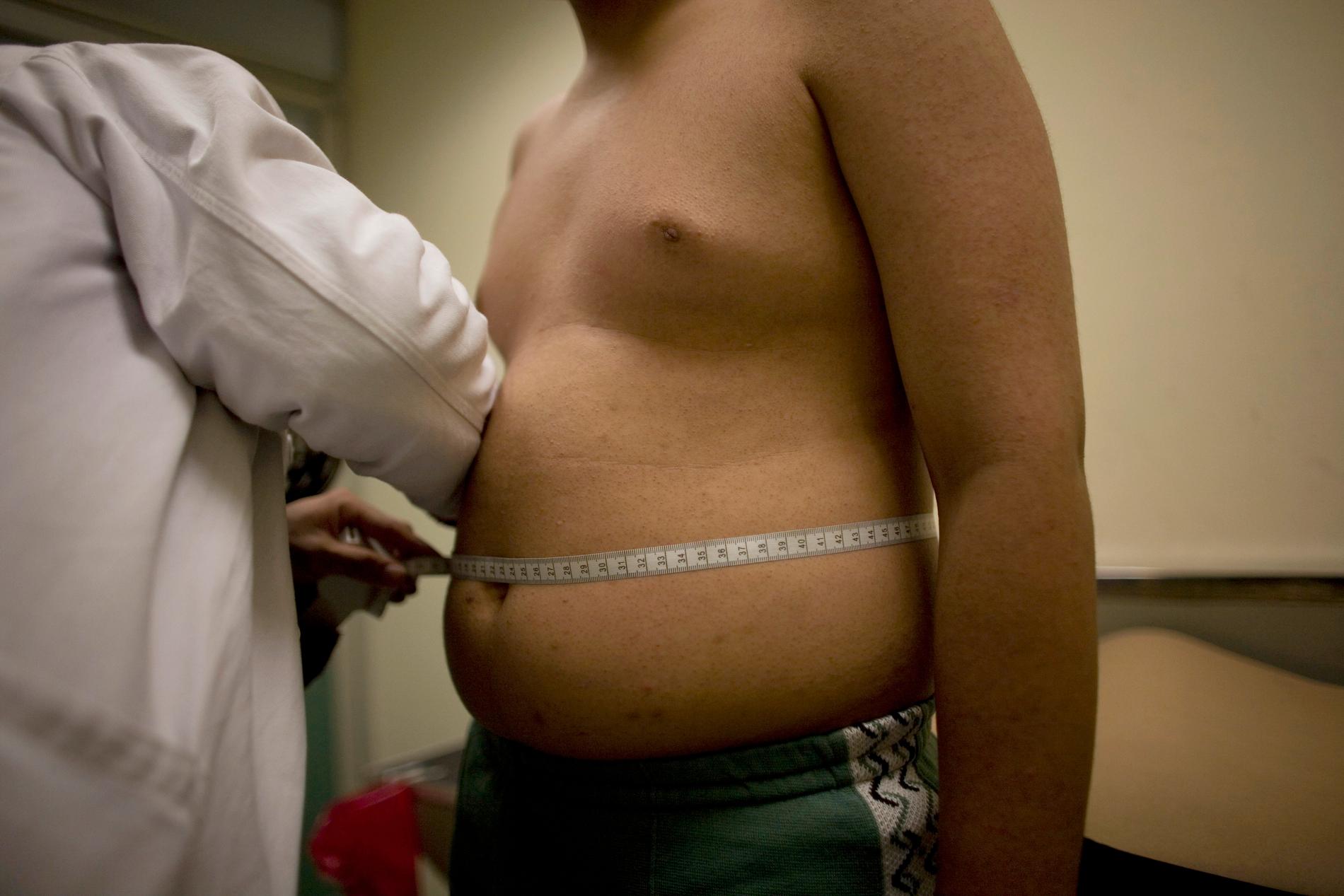 Fler patienter betalar själv för fetmaoperationer. Andelen har stigit från 13 procent år 2015 till 22 procent i fjol, enligt Dagens Medicin. Arkivbild.