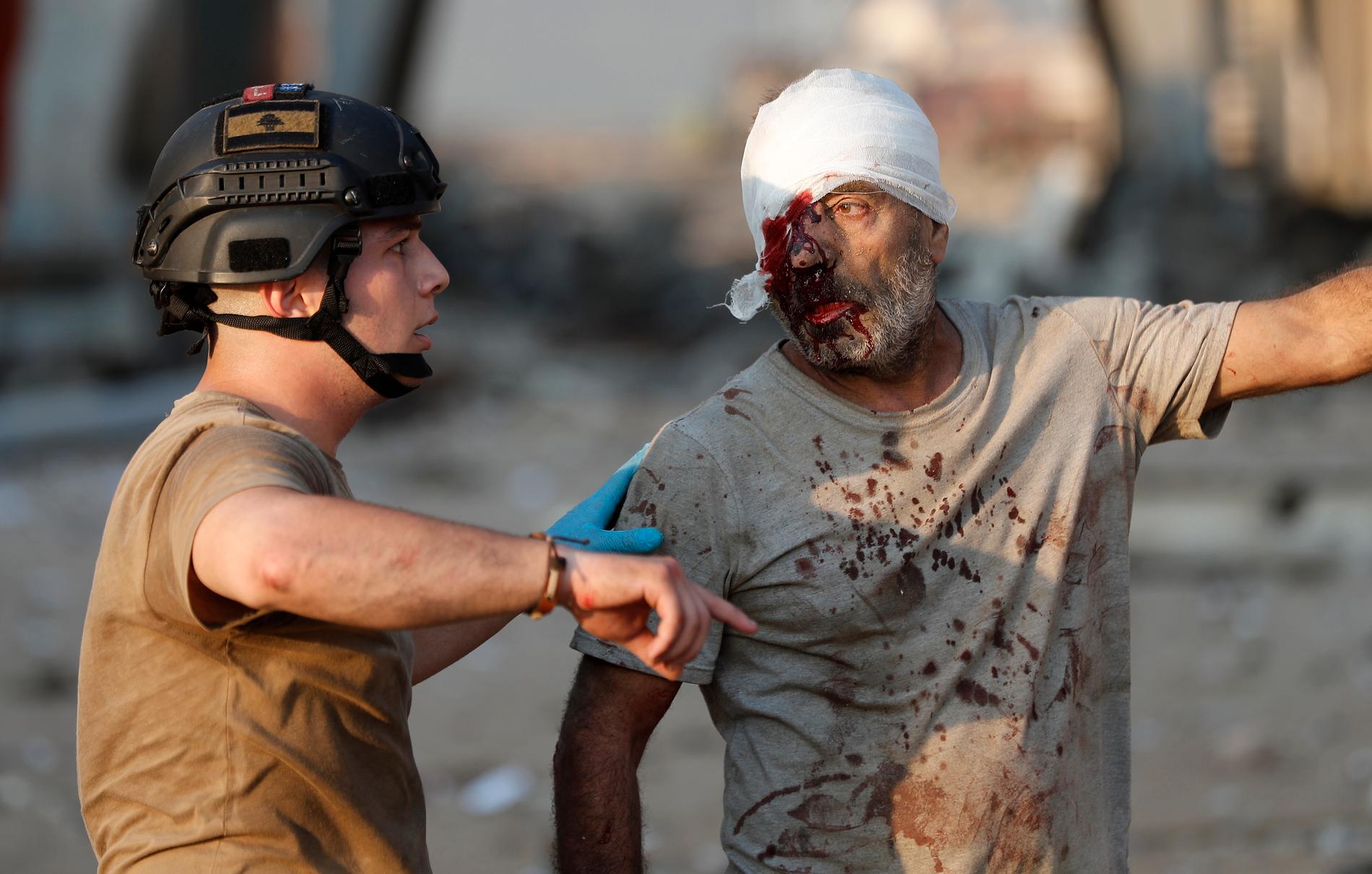 Libanesiska myndigheter har hittills bekräftat 78 döda och över 4 000 skadade.