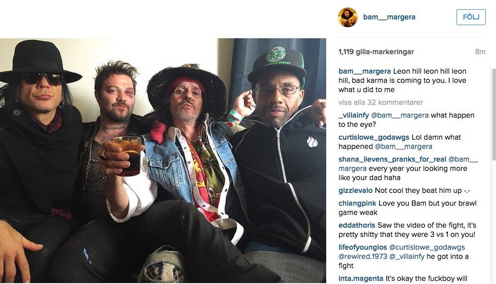 Bam Margera visar upp blåtiran på Instagram.