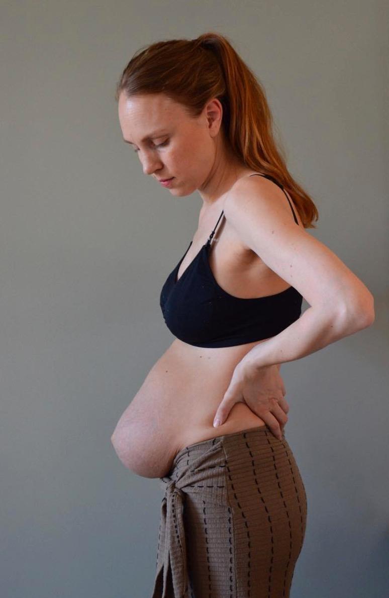 Nu visar hon upp magen efter förlossningen.