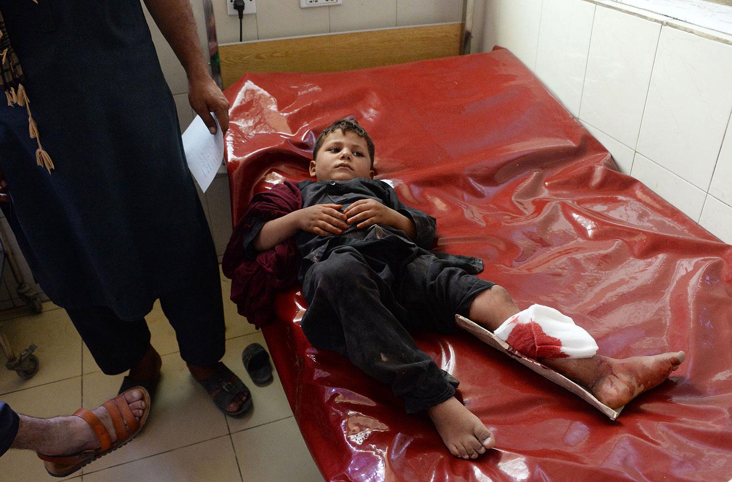 En skadad pojke får vård på ett sjukhus efter att flera explosioner inträffat i Jalalabad.