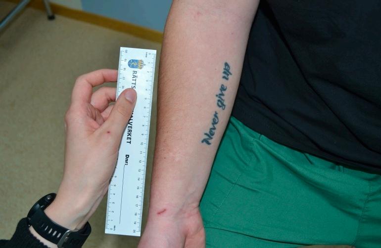 En bild på ett sår på Philip Grahns arm, från förundersökningsprotokollet. 