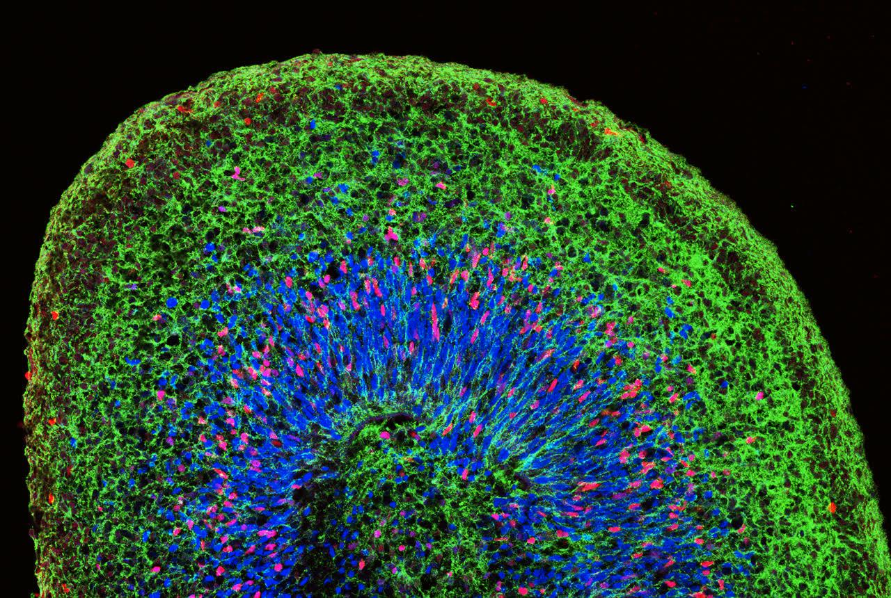 Med hjälp av stamceller går det att odla fram vävnad som påminner om en hjärna i miniformat. Arkivbild.