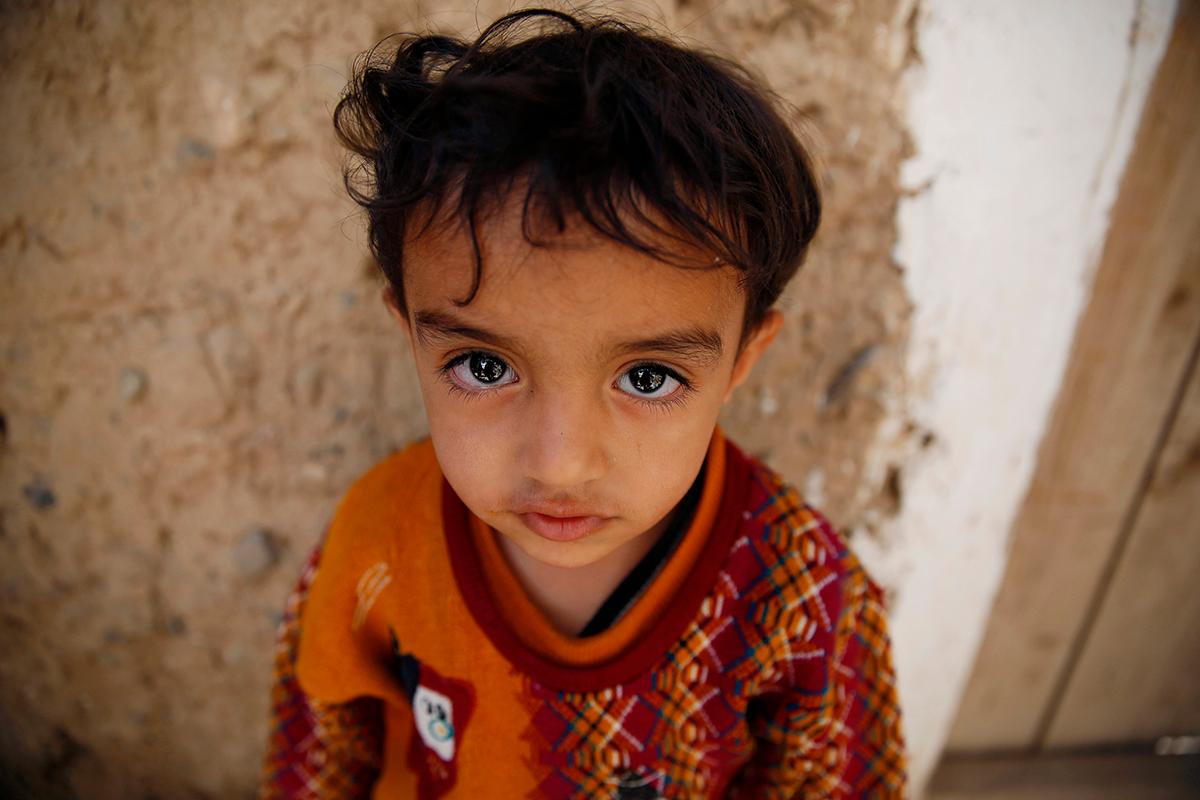 Sanaa, Yemen: En ung pojke har just vaccinerats mot Polio i sitt hem. En tredagarskampanj för att vaccinera barn i landet påbörjades i måndags och man hoppas kunna vaccinera totalt fem miljoner barn.