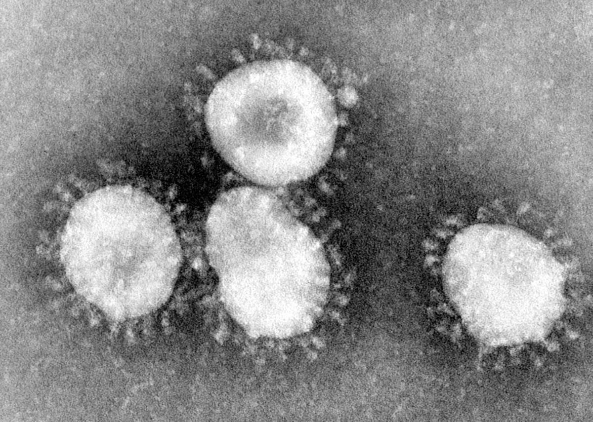 Coronavirus.