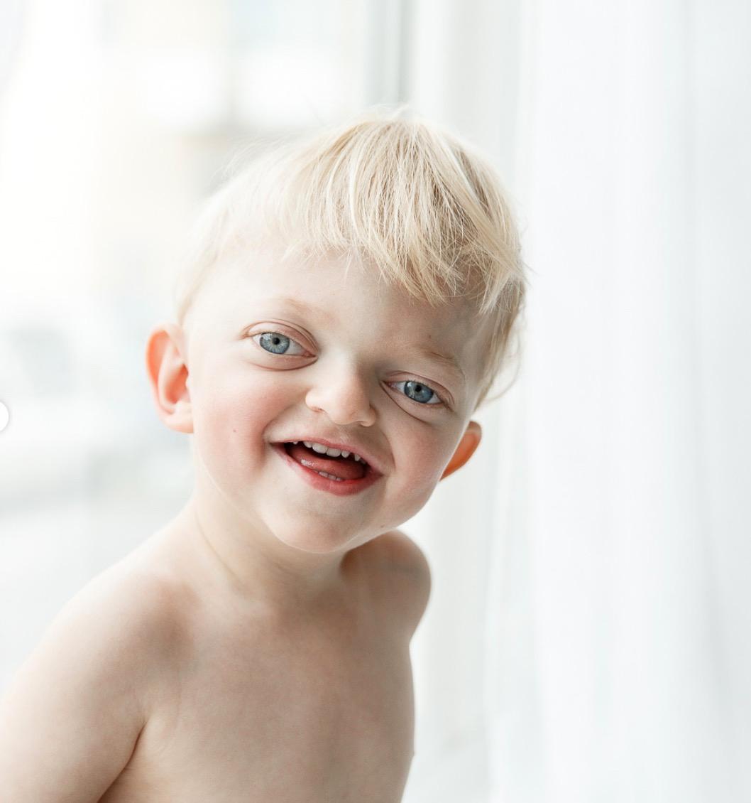 Elliot, 3, har Crouzon syndrom –nu sprider han glädje till tusentals på Instagram genom att baka. 