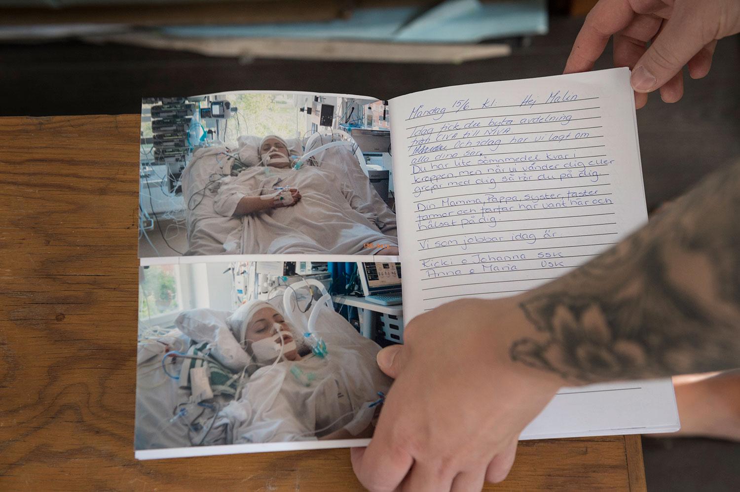 Den 15 juni förra året. Medan Malin ligger nedsövd skriver sjuksköterskorna och familjen dagbok över vad som hänt, vilka som hälsat på henne.