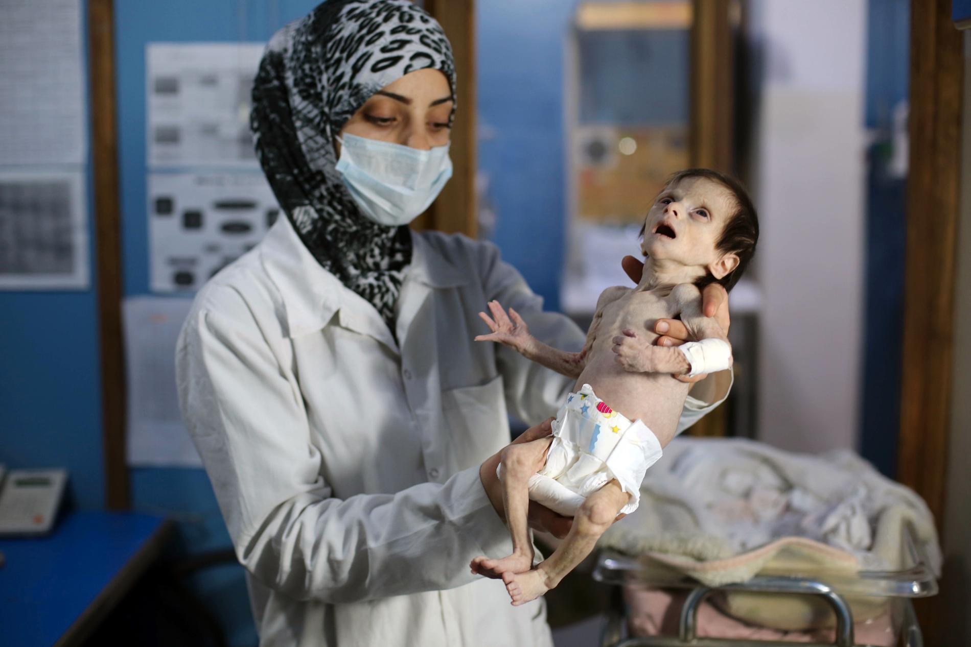 Ett syriskt barn på sjukhuset i Ghouta