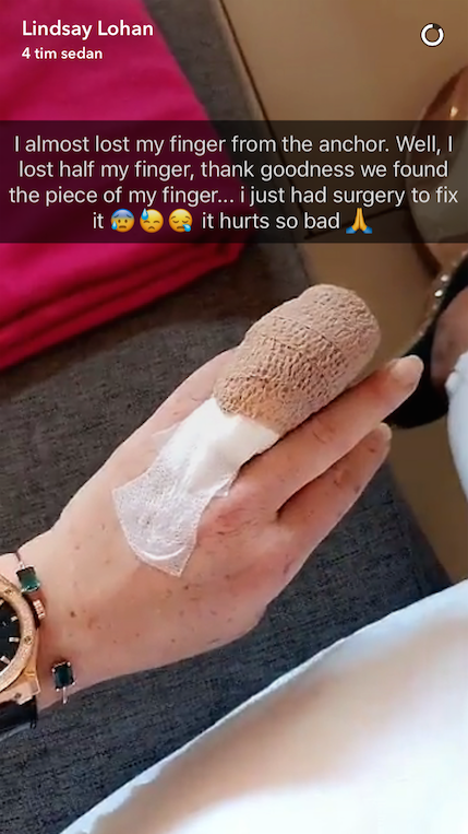 Lindsay Lohan förlorade nästan sitt ringfinger i olyckan.