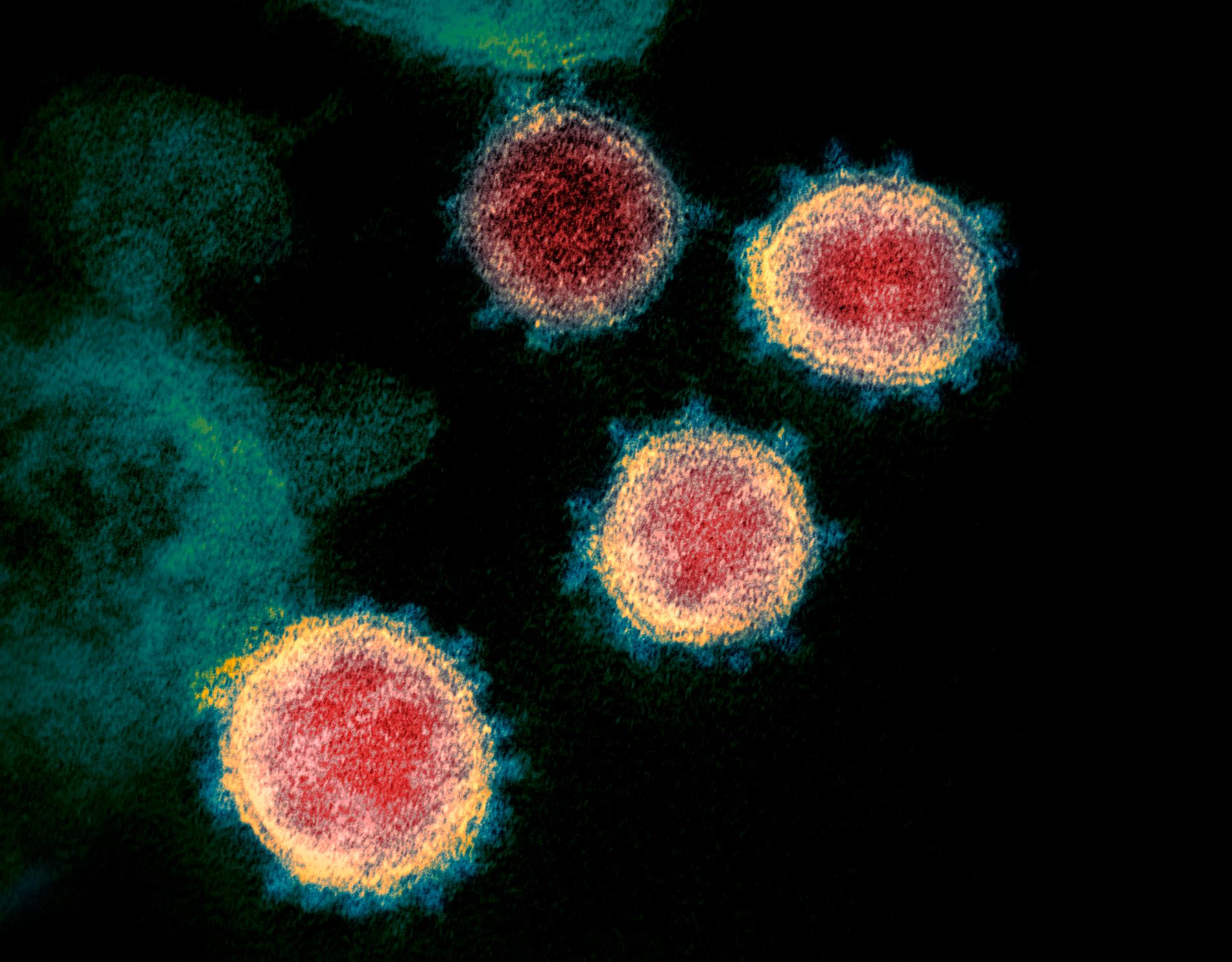 Coronaviruset sars-cov-2, sett genom mikroskop. Arkivbild.