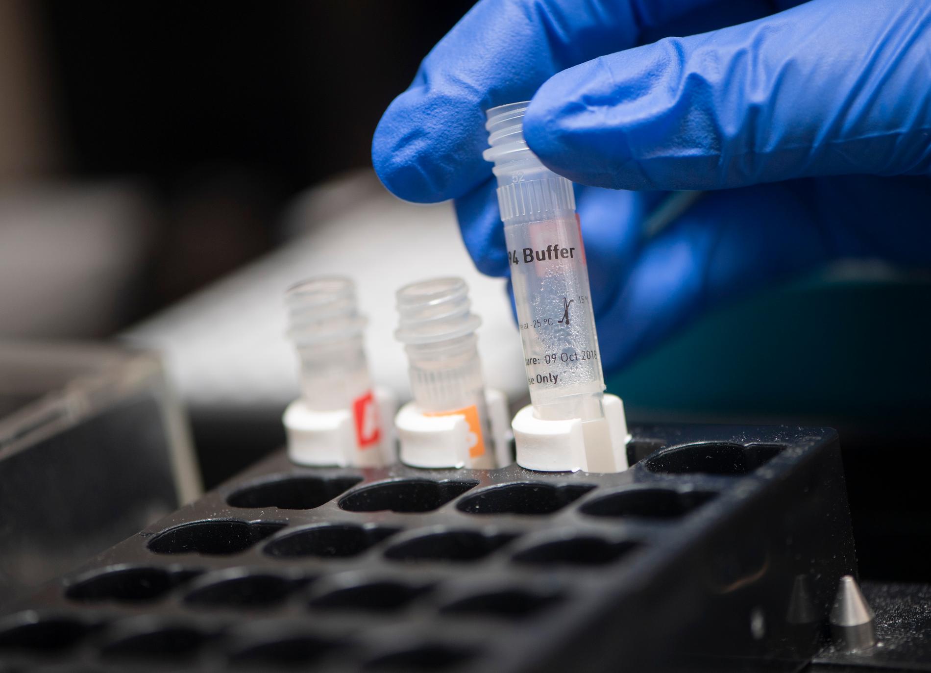 PCR-testerna, som mäter pågående infektion av covid-19, kan visa ett negativt provsvar, även när en patient är sjuk i covid-19. Arkivbild.