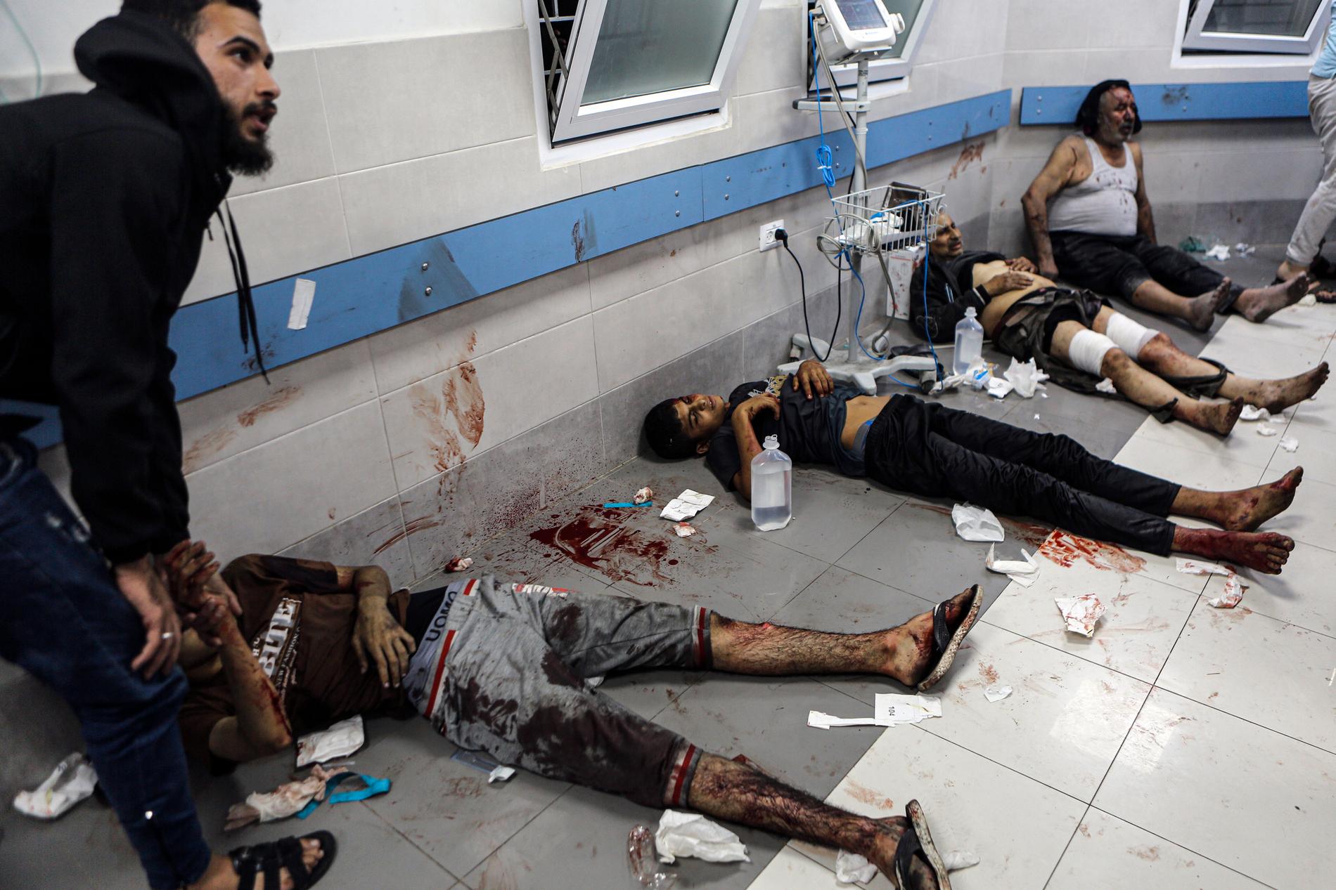 Palestinier som skadades under explosionen vid al-Ahli-sjukhuset i Gaza har förts till Al Shifa-sjukhuset, den 17 oktober, 2023.