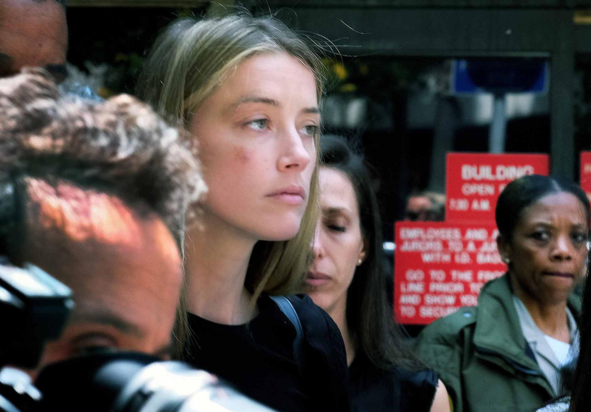 Amber Heard i domstol i Los Angeles, där hon visade upp skador i sitt ansikte som Johnny Depp ska ha åsamkat henne.