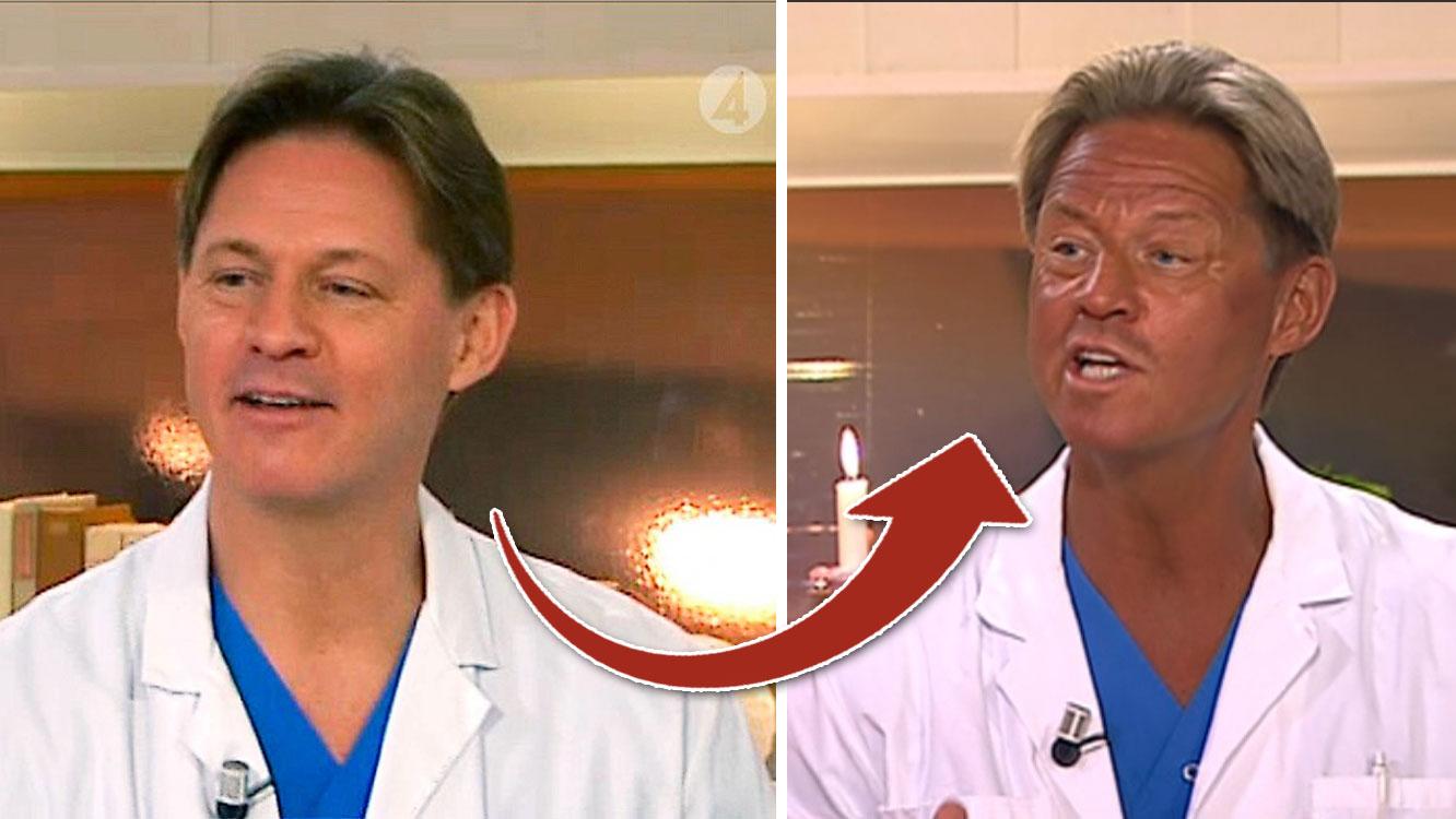 FÖRVANDLINGEN Tv-läkaren före och efter sin solsemester.