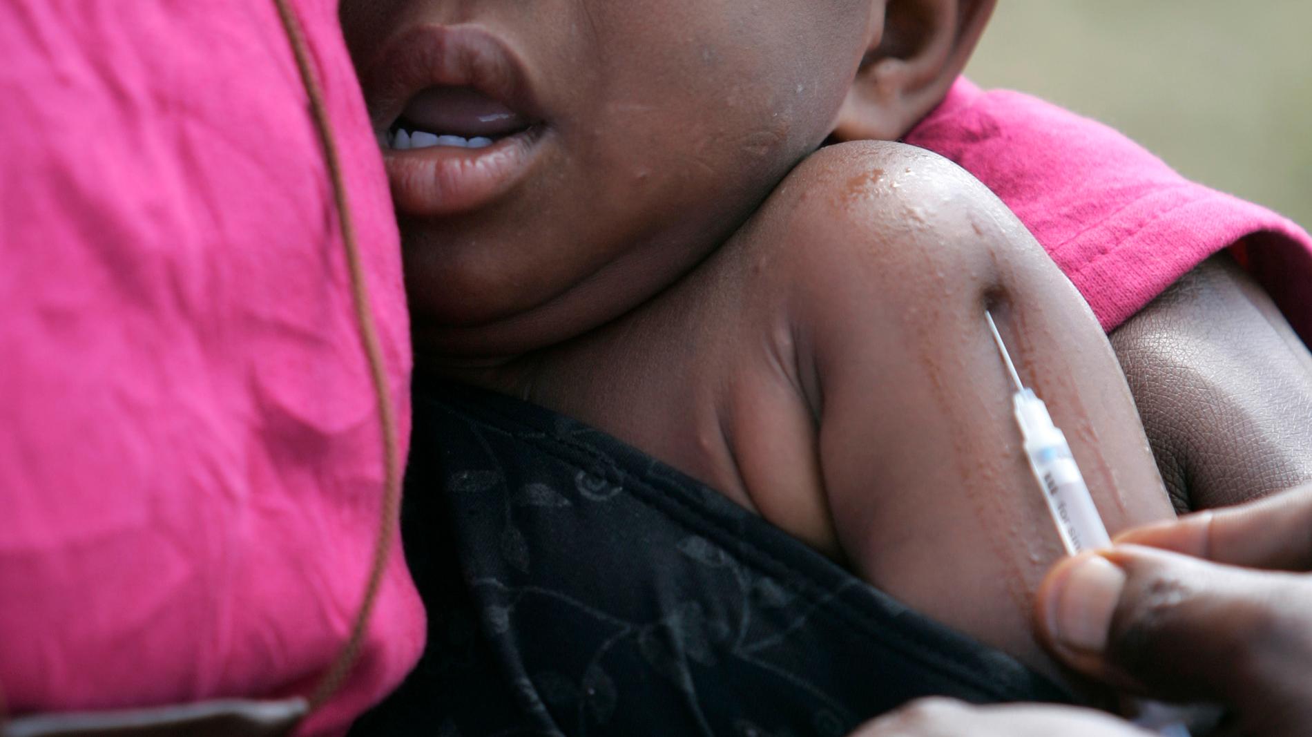 En pojke i Kongo-Kinshasa vaccineras mot mässlingen. Arkivbild.