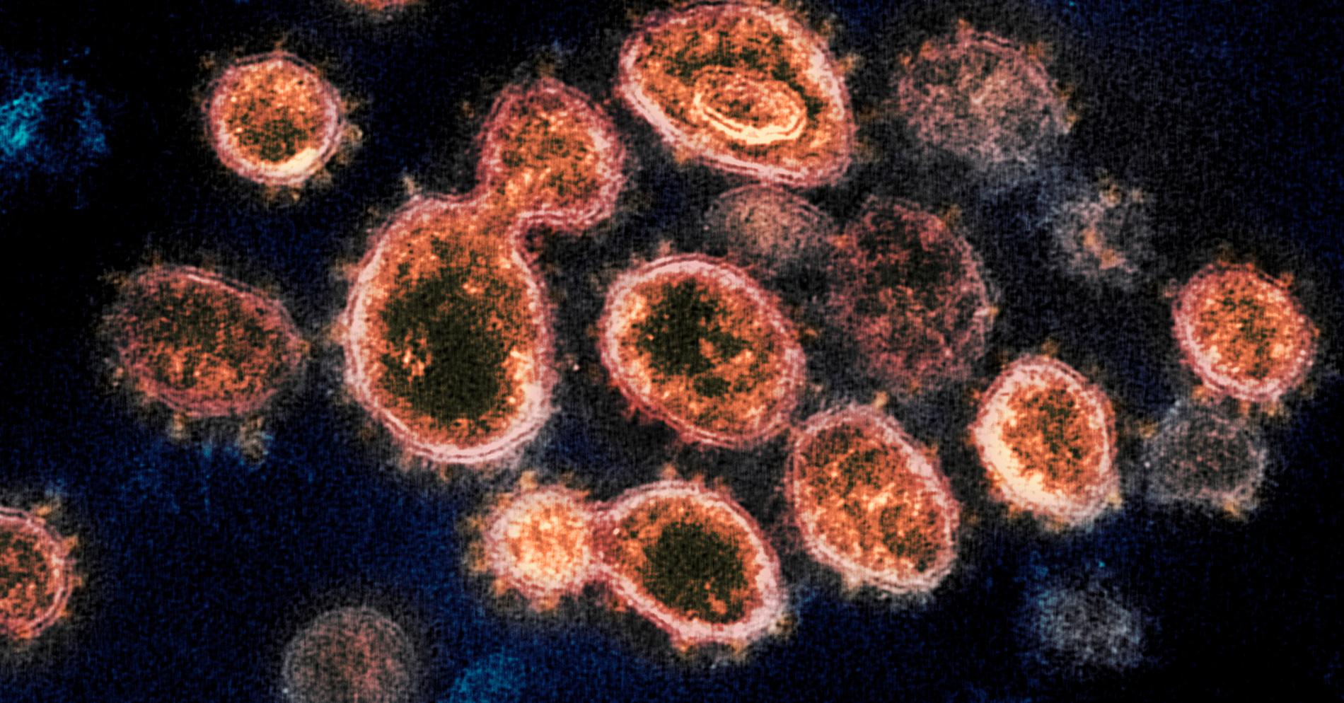 Viruset SARS-CoV-2 orsakar covid-19.