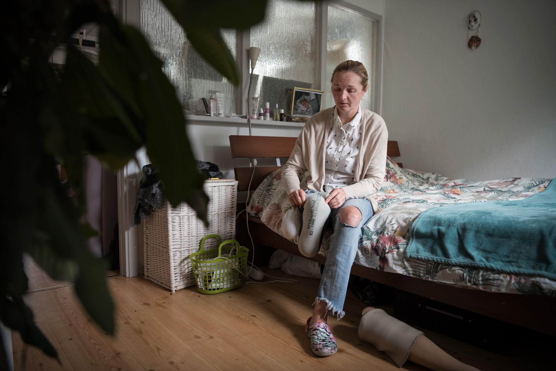 Vid terrorattacken blev Iryna av med sitt högra ben, sedan sjukhusvistelsen har hon fått byta protes var tredje månad för att den ska passa benstumpen. 