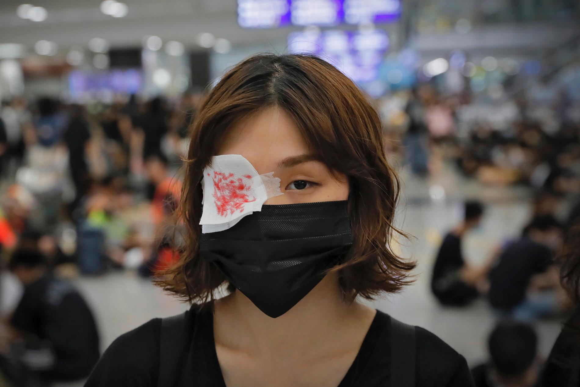 I sympati med en kvinna som ska ha fått sitt öga sönderskjutet av en polis bar demonstranterna på Hongkongs flygplats under måndagen rödmålade lappar över ögonen.
