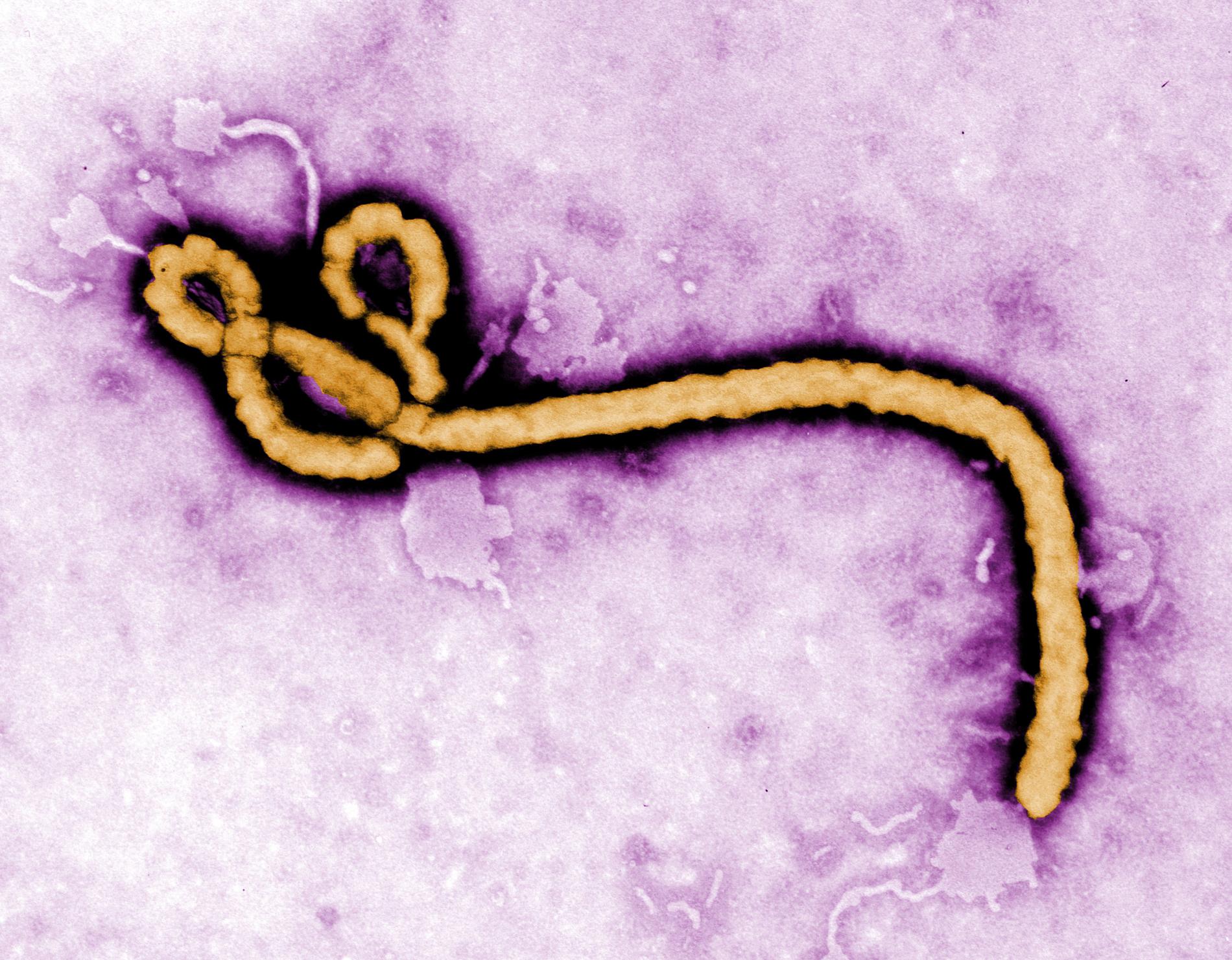 Ett ebolavirus. Arkivbild.