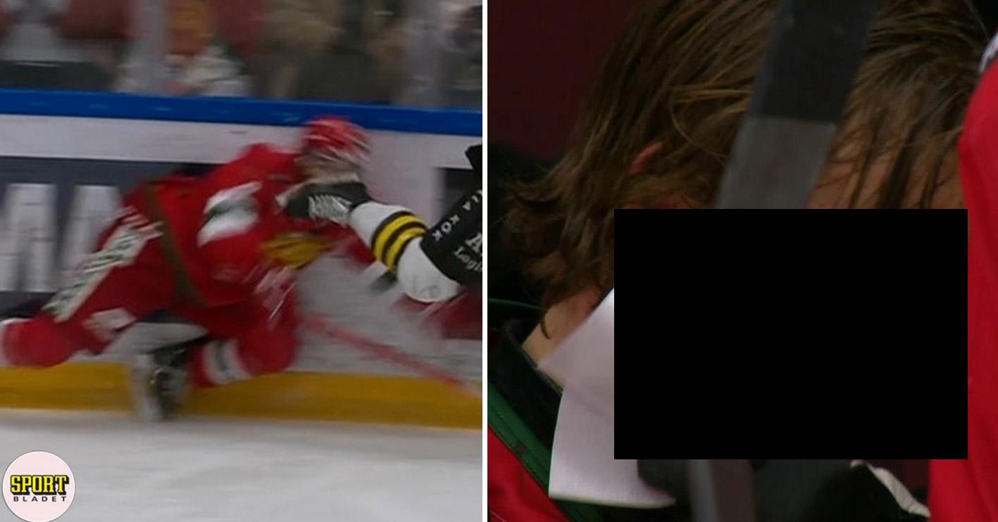 HockeyAllsvenskan: Skräckskadan: Träffas rakt i ansiktet