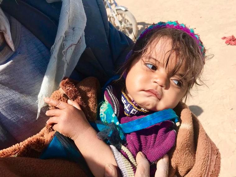 Tvååriga Fahina kan varken andas eller äta ordentligt, och hennes familj har inte råd att ta henne till ett sjukhus för behandling. De har tvingats fly sitt hem i Sa'ada i Jemen och lever nu under tuffa förhållanden i flyktingläger.