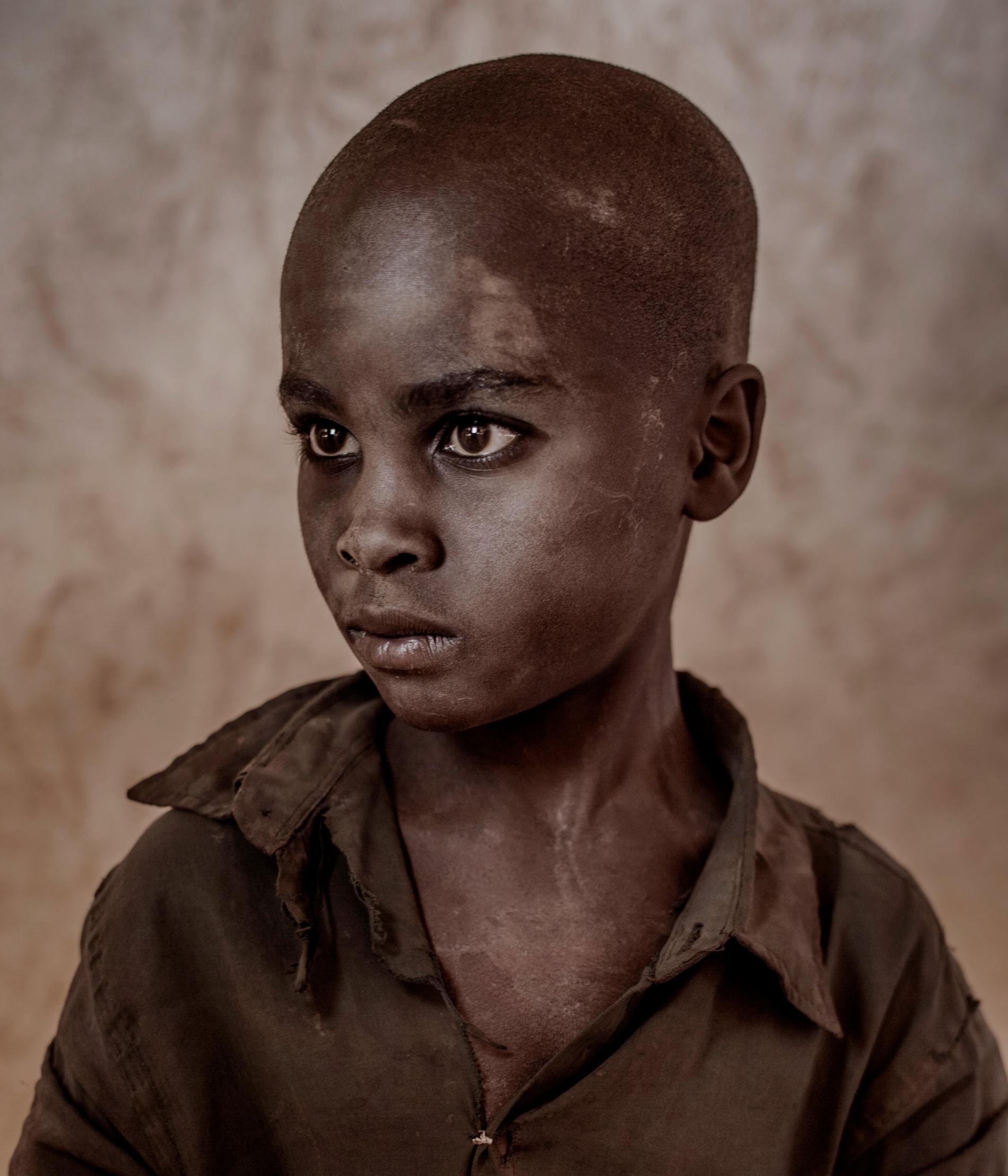 Årets fotograf 2017, Magnus Wennman.  Malawi är ett av världens fattigaste länder. Här är torkan och svälten ett faktum samtidigt som människor är på flykt undan krig, mord och förföljelse.  Moses, 11. 
